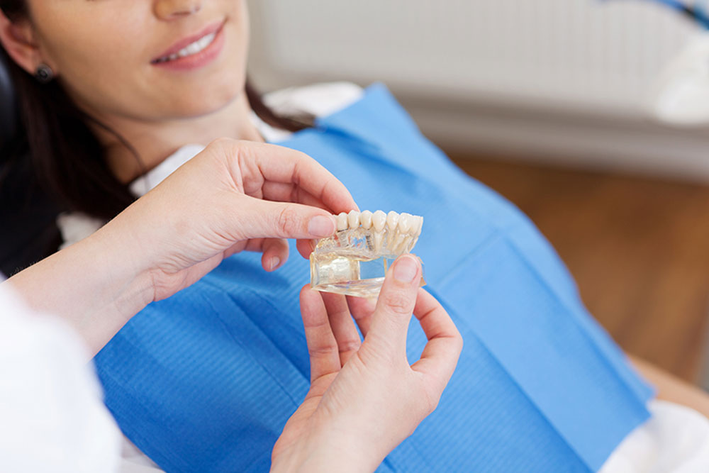 Diagonal Dent - Implantes dentales