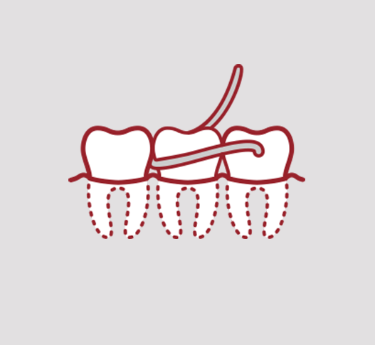 Diagonal Dent - Odontología Conservadora